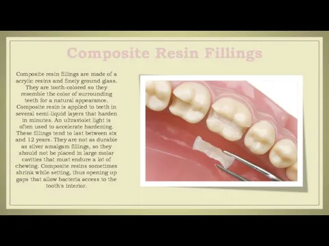 Composite resin fillings are made of a acrylic resins and
