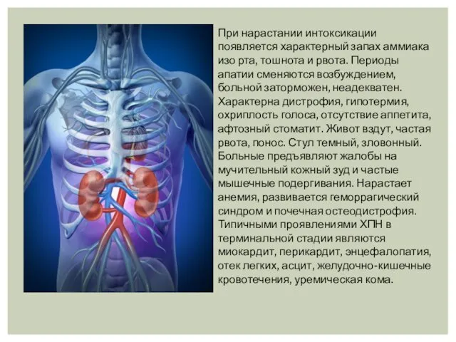 При нарастании интоксикации появляется характерный запах аммиака изо рта, тошнота