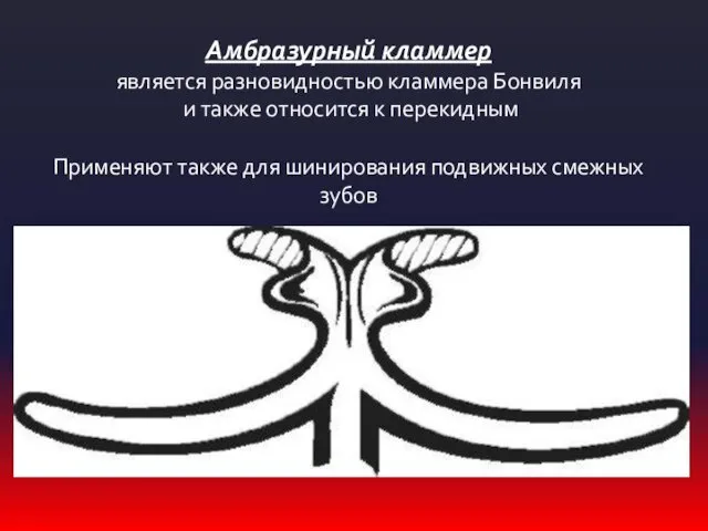 Амбразурный кламмер является разновидностью кламмера Бонвиля и также относится к