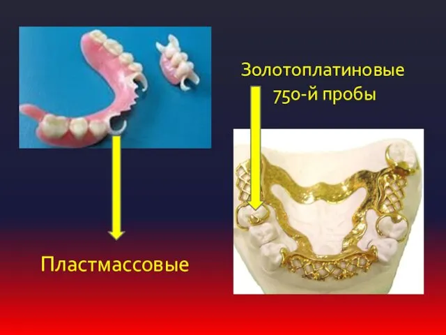 Золотоплатиновые 750-й пробы Пластмассовые