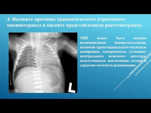 4. Назовите причины травматического ятрогенного пневмоторакса и оцените представленную рентгенограмму.