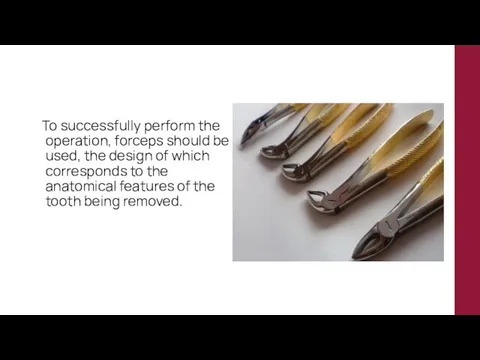 To successfully perform the operation, forceps should be used, the