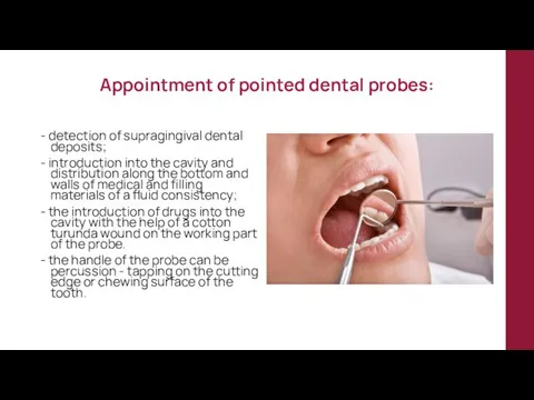 Appointment of pointed dental probes: - detection of supragingival dental