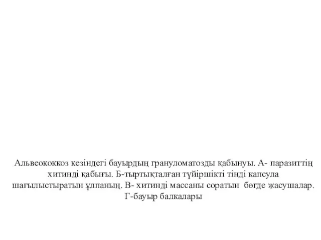 Альвеококкоз кезіндегі бауырдың грануломатозды қабынуы. А- паразиттің хитинді қабығы. Б-тыртықталған