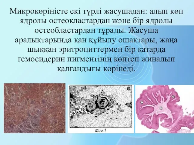 Микрокөріністе екі түрлі жасушадан: алып көп ядролы остеокластардан және бір