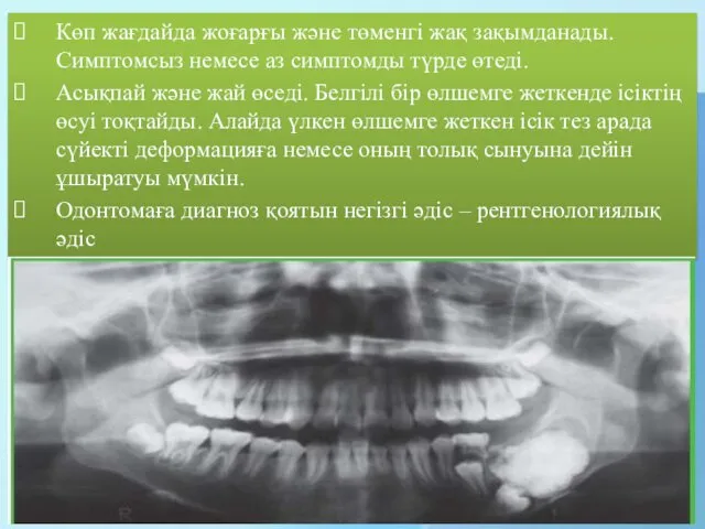 Көп жағдайда жоғарғы және төменгі жақ зақымданады. Симптомсыз немесе аз