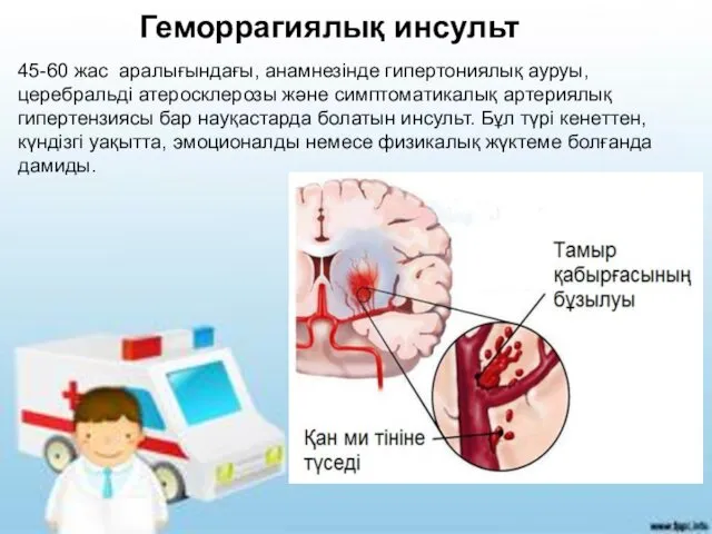 45-60 жас аралығындағы, анамнезінде гипертониялық ауруы, церебральді атеросклерозы және симптоматикалық артериялық гипертензиясы бар