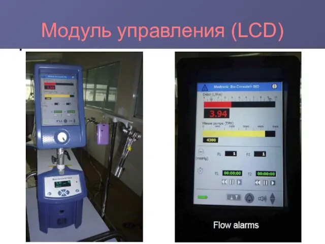 Модуль управления (LCD)