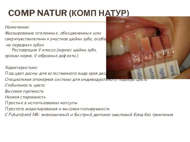 COMP NATUR (КОМП НАТУР) Назначение: Маскирование оголенных, обесцвеченных или сверхчувствительных участков шейки зуба,