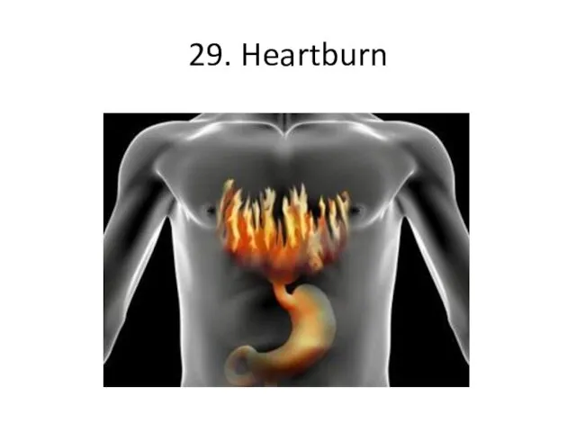 29. Heartburn