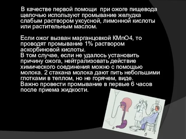 В качестве первой помощи при ожоге пищевода щелочью используют промывание