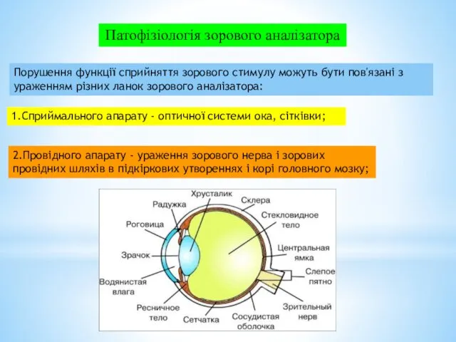 Патофізіологія зорового аналізатора Порушення функції сприйняття зорового стимулу можуть бути