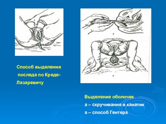 Способ выделения последа по Креде- Лазаревичу Выделение оболочек а –