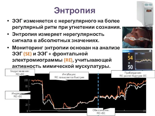 Энтропия ЭЭГ изменяется с нерегулярного на более регулярный ритм при