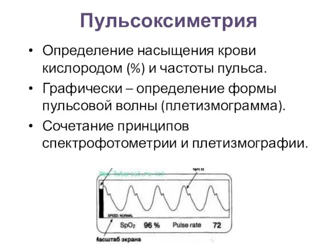 Пульсоксиметрия Определение насыщения крови кислородом (%) и частоты пульса. Графически