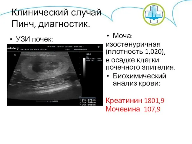 Клинический случай Пинч, диагностик. УЗИ почек: нефросклероз Моча: изостенуричная (плотность