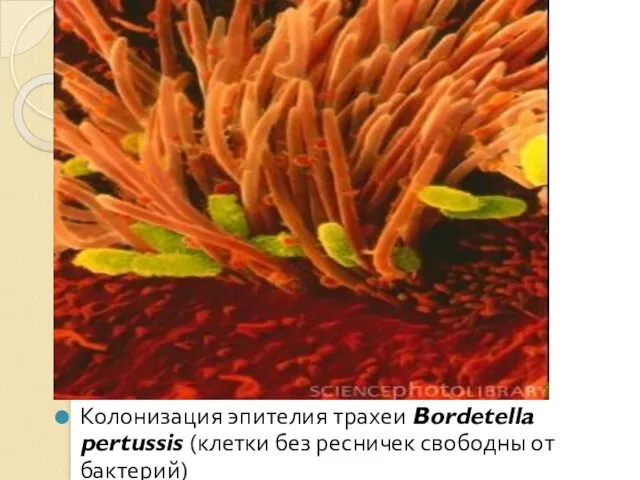 Колонизация эпителия трахеи Bordetella pertussis (клетки без ресничек свободны от бактерий)