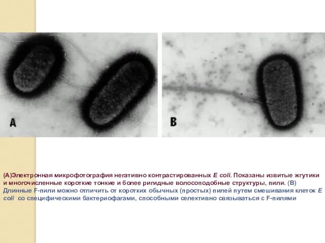 (А)Электронная микрофотография негативно контрастированных E coli. Показаны извитые жгутики и