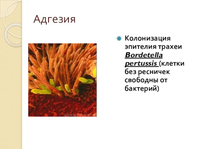 Адгезия Колонизация эпителия трахеи Bordetella pertussis (клетки без ресничек свободны от бактерий)