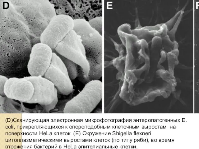 (D)Сканирующая электронная микрофотография энтеропатогенных Е. coli, прикрепляющихся к опороподобным клеточным