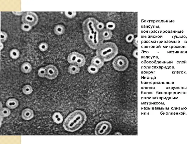 Бактериальные капсулы, контрастированные китайской тушью, рассматриваемые в световой микроскоп. Это