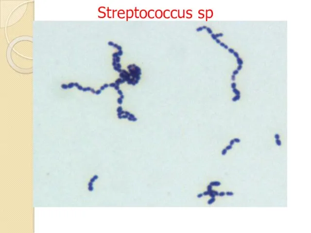 Streptococcus sp