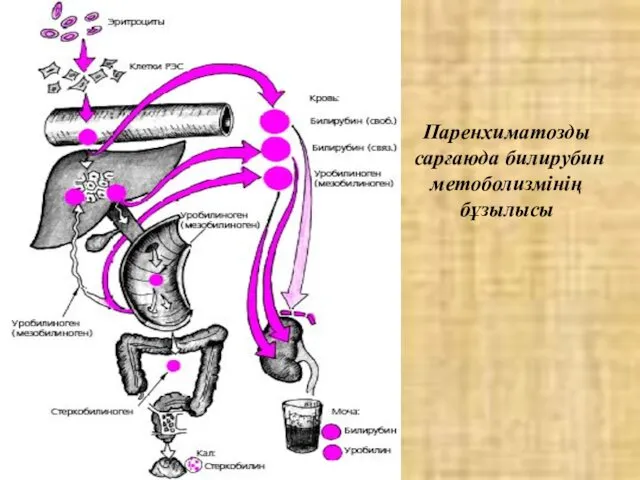 Паренхиматозды сарғаюда билирубин метоболизмінің бұзылысы