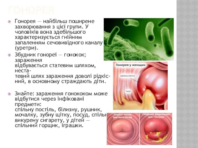 ГОНОРЕЯ Гонорея — найбільш поширене захворювання з цієї групи. У