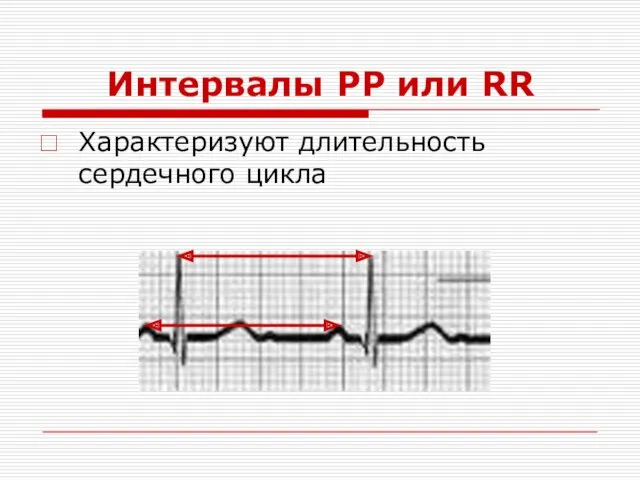 Интервалы PP или RR Характеризуют длительность сердечного цикла