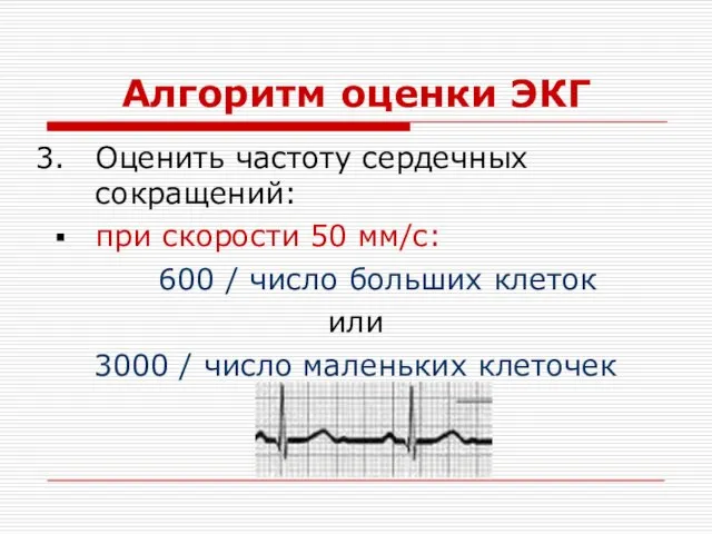 Алгоритм оценки ЭКГ Оценить частоту сердечных сокращений: при скорости 50 мм/с: 600 /