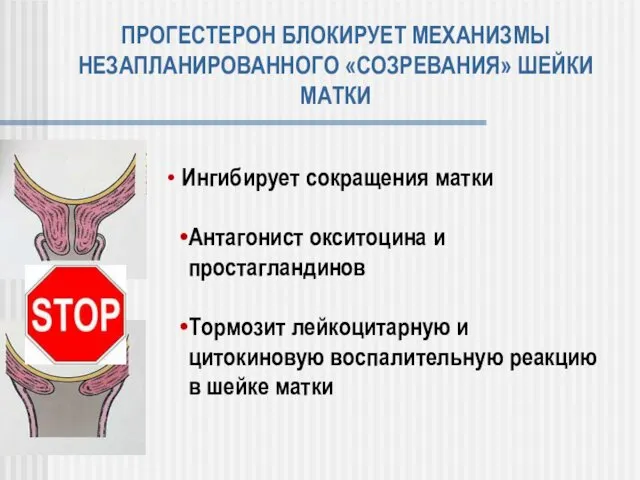 ПРОГЕСТЕРОН БЛОКИРУЕТ МЕХАНИЗМЫ НЕЗАПЛАНИРОВАННОГО «СОЗРЕВАНИЯ» ШЕЙКИ МАТКИ Ингибирует сокращения матки