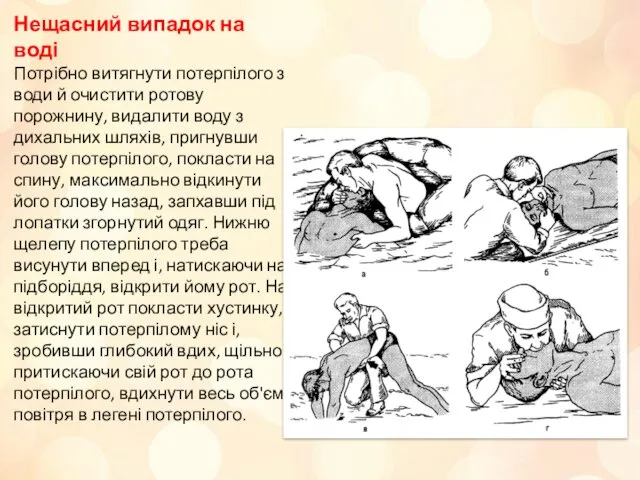 Нещасний випадок на воді Потрібно витягнути потерпілого з води й