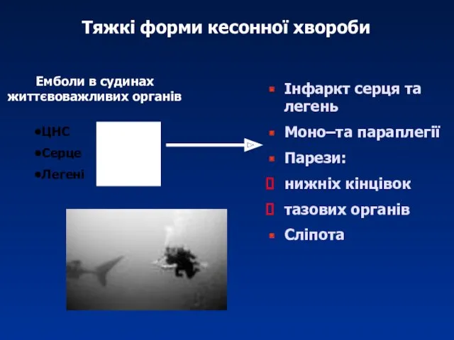 Тяжкі форми кесонної хвороби Емболи в судинах життєвоважливих органів ЦНС