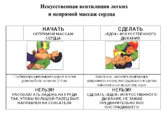 Искусственная вентиляция легких и непрямой массаж сердца