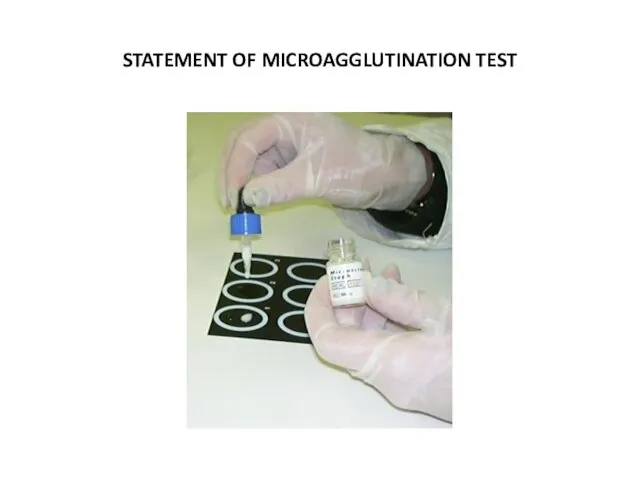 STATEMENT OF MICROAGGLUTINATION TEST