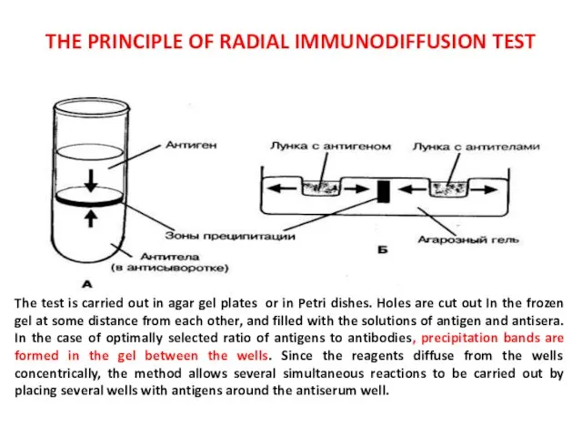 THE PRINCIPLE OF RADIAL IMMUNODIFFUSION TEST The test is carried