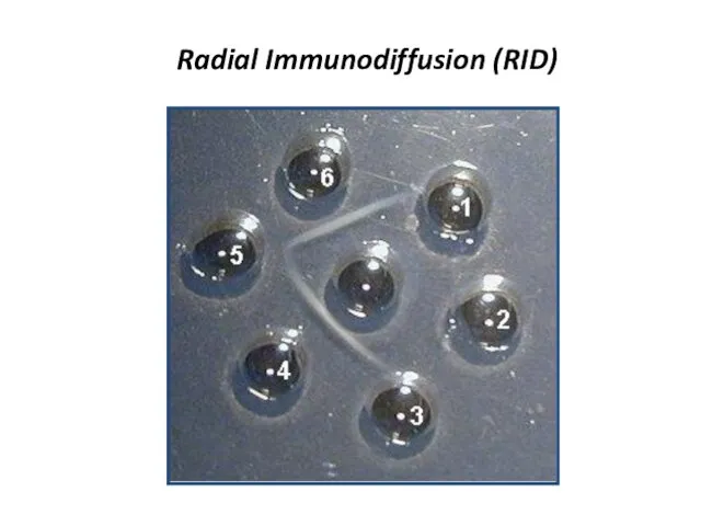 Radial Immunodiffusion (RID)