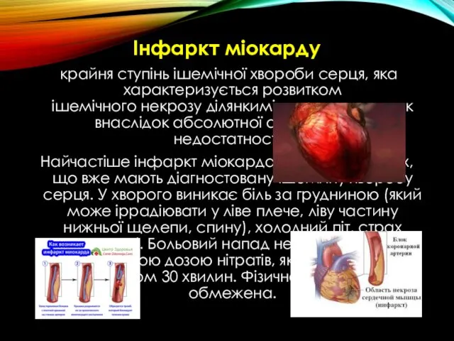 Інфаркт міокарду крайня ступінь ішемічної хвороби серця, яка характеризується розвитком