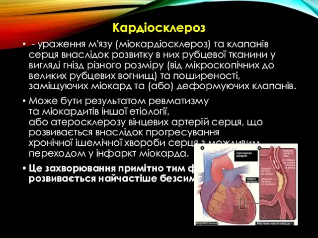 Кардіосклероз - ураження м'язу (міокардіосклероз) та клапанів серця внаслідок розвитку