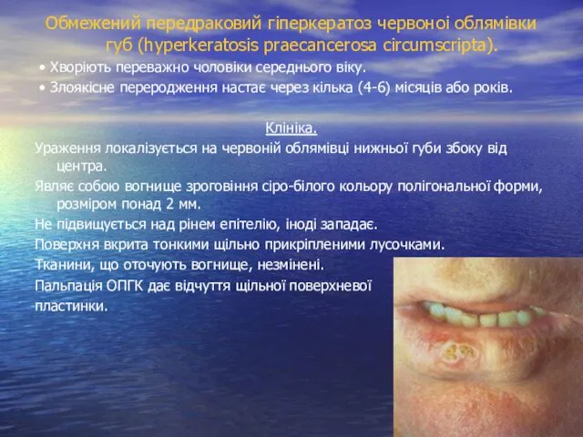 Обмежений передраковий гіперкератоз червоноі облямівки губ (hyperkeratosis praecancerosa circumscripta). •