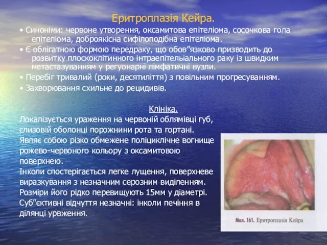 Еритроплазія Кейра. • Синоніми: червоне утворення, оксамитова епітеліома, сосочкова гола