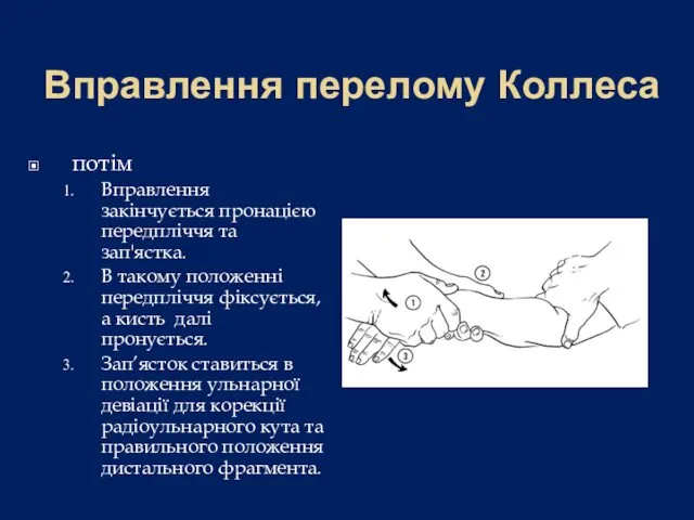 Вправлення перелому Коллеса потім Вправлення закінчується пронацією передпліччя та зап'ястка. В такому положенні