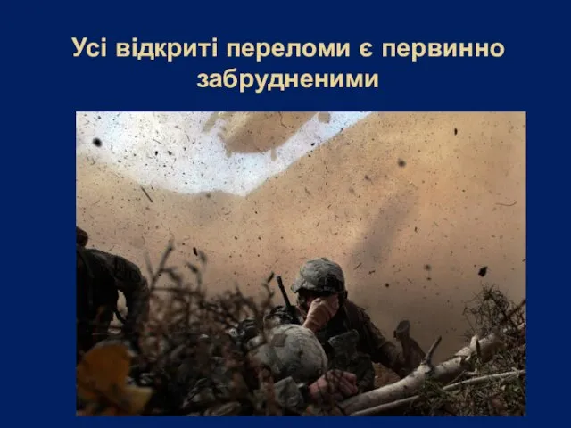 Усі відкриті переломи є первинно забрудненими