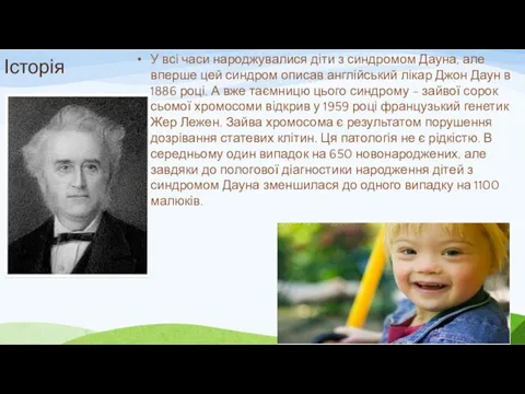 Історія У всі часи народжувалися діти з синдромом Дауна, але