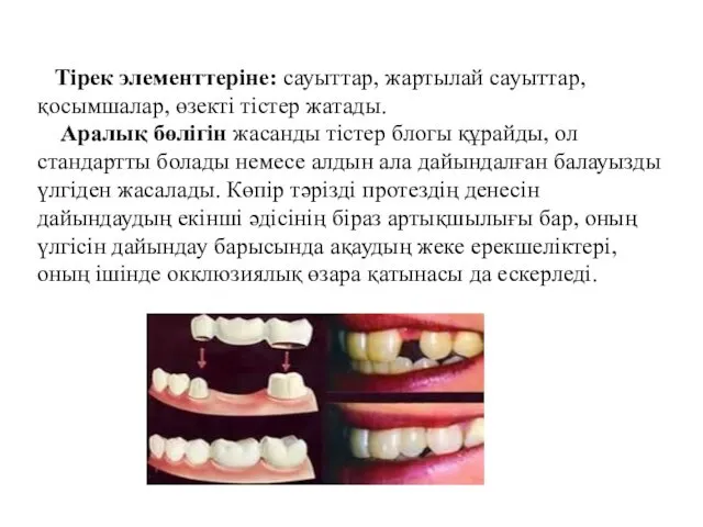 Тірек элементтеріне: сауыттар, жартылай сауыттар, қосымшалар, өзекті тістер жатады. Аралық