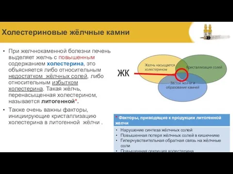 Холестериновые жёлчные камни При желчнокаменной болезни печень выделяет желчь с