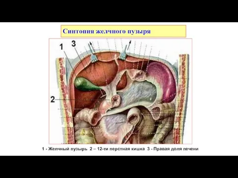 Синтопия желчного пузыря 1 - Желчный пузырь 2 – 12-ти