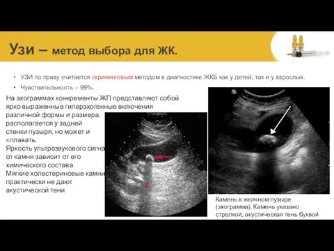 Узи – метод выбора для ЖК. УЗИ по праву считается