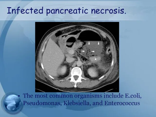 Infected pancreatic necrosis. The most common organisms include E.coli, Pseudomonas, Klebsiella, and Enterococcus