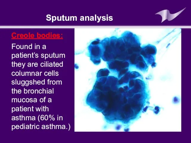 Sputum analysis Creole bodies: Found in a patient’s sputum they